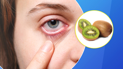 क्या कीवी खाने से आंखों की रोशनी बढ़ती है? जानें इसे खाने से जुड़ी सावधानियां